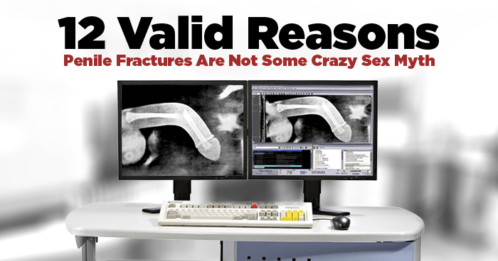 12-Valid-Reasons-Penile-Fractures-Are-Not-Some-Crazy-Sex-Myth